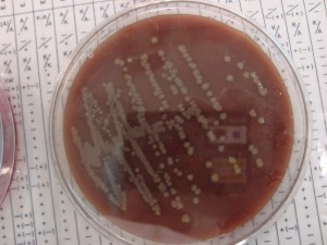 E. coli culture